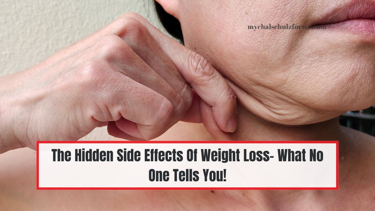 The Hidden Side Effects Of Weight Loss- What No One Tells You!