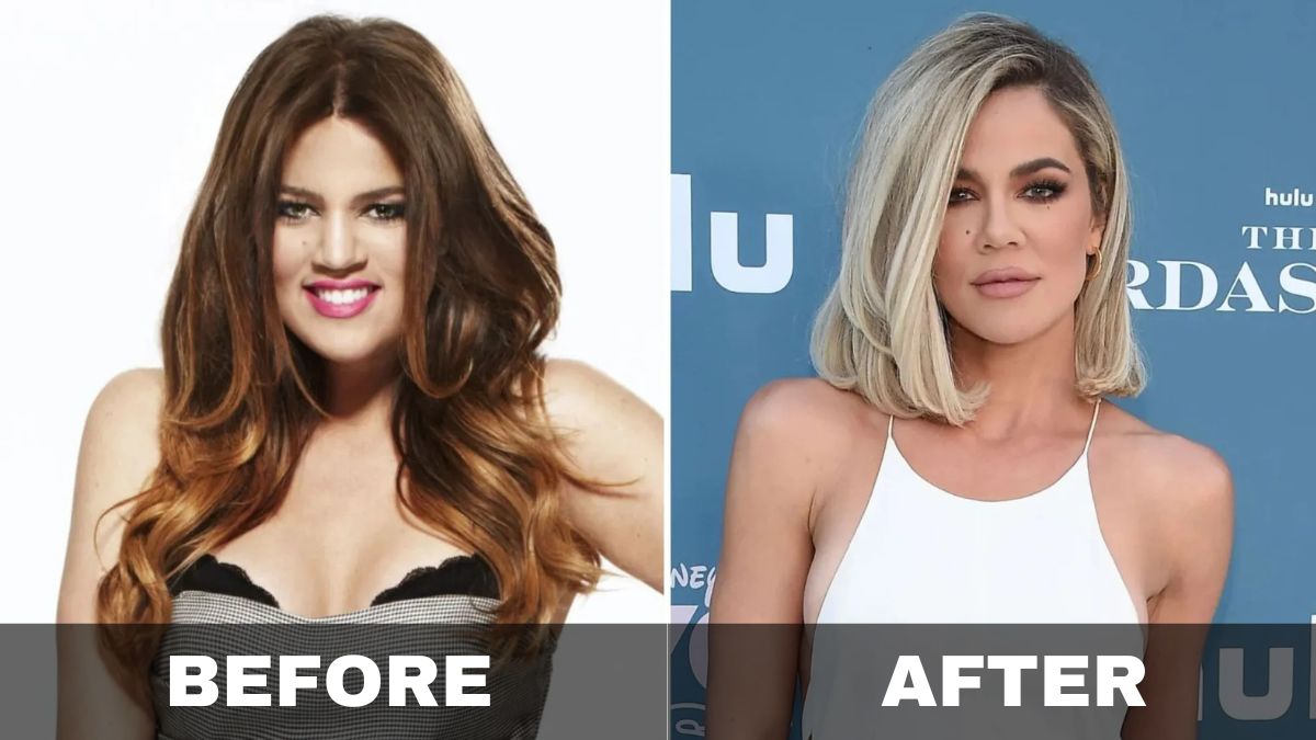 Khloe Kardashian's Weight Loss Journey: Shedding 40 Pounds After Divorce and Having a Baby