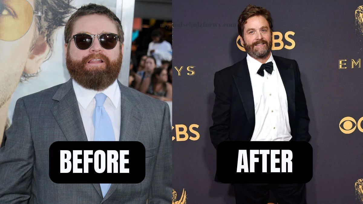 Zach Galifianakis Remarkable Weight Loss Journey: From 'The Hangover' To Healthier Living